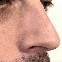 NOSE PATCHES