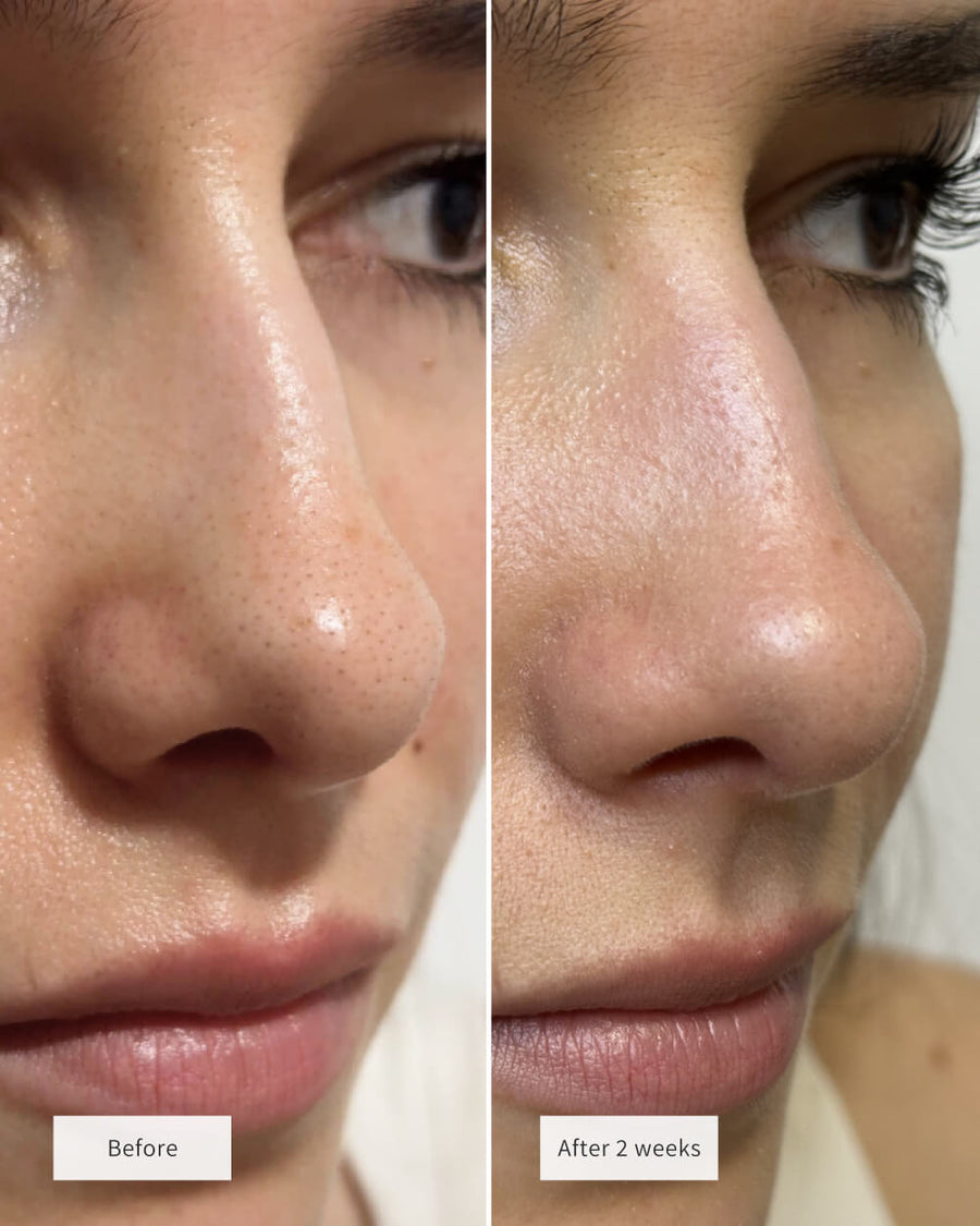 CLEAR PORE DUO